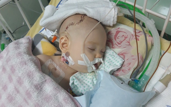 Małe dziecko w szpitalu, z opatrunkiem na głowie.