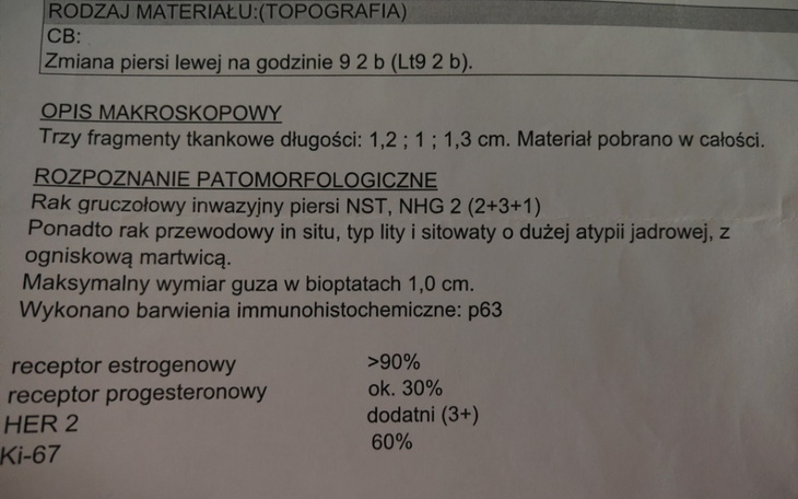 Zbiórka Pomoc w zakupie protezy i peruki - zdjęcie główne