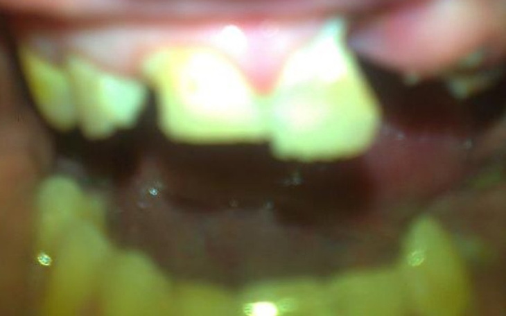 Zbiórka Na operację zębów - zdjęcie główne