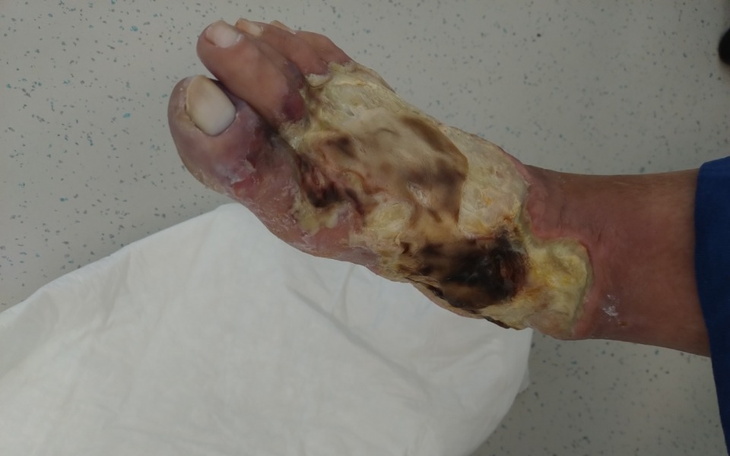 Zbiórka Wyleczenie nogi - zdjęcie główne