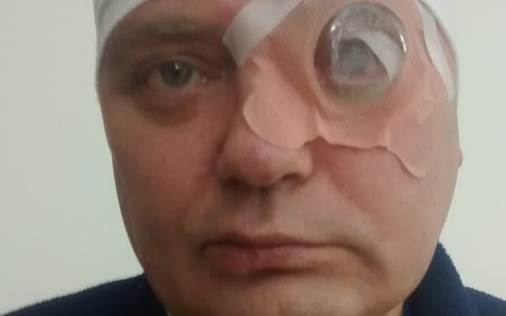 Mężczyzna z opatrunkiem na oku po operacji.