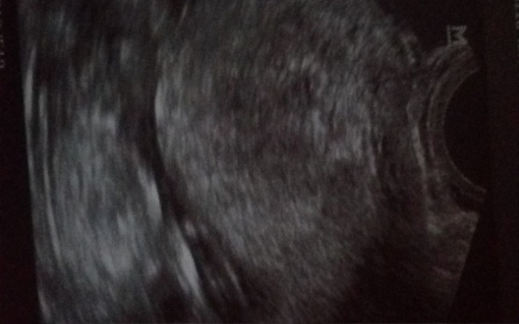 Zbiórka Splata dlugow ,normalnie zyc - zdjęcie główne