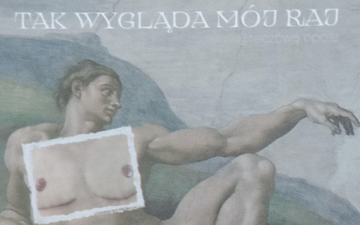 Zbiórka top surgery - daniel - zdjęcie główne