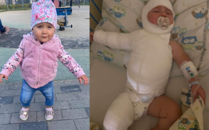 Zbiórka Leczenie poparzonej Lilusi - zdjęcie główne