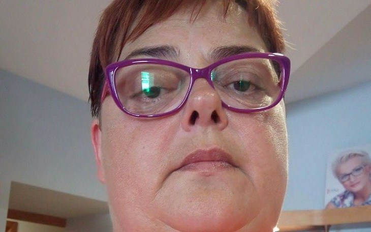 Zbiórka Zbiórka na leczenie mamy - zdjęcie główne