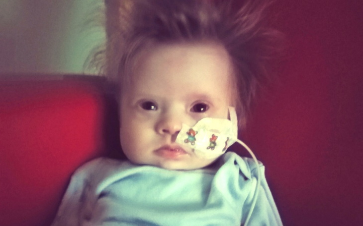 Dziecko z aparaturą medyczną, wyrażające spokój.