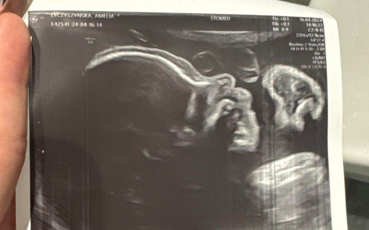 Zbiórka Ubranka dla dziecka - zdjęcie główne