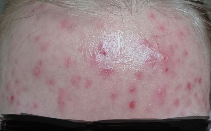 Zbiórka Leczenie skóry - zdjęcie główne