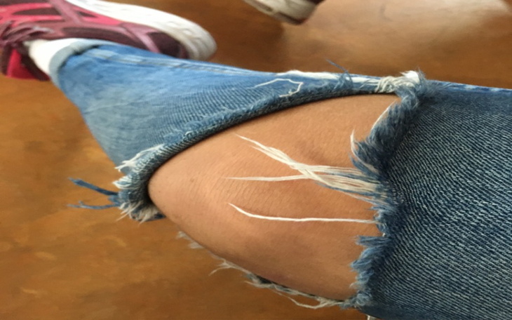 Zbiórka Na spodnie dla Natali i Leny - zdjęcie główne