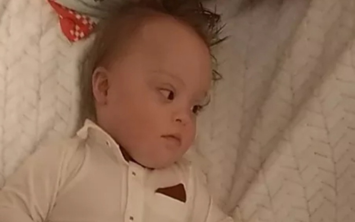 Zbiórka Rechabilitacja ruchowa - zdjęcie główne