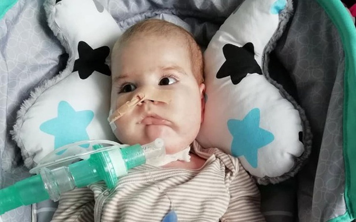 Zbiórka Na rehabilitację Jasia - zdjęcie główne