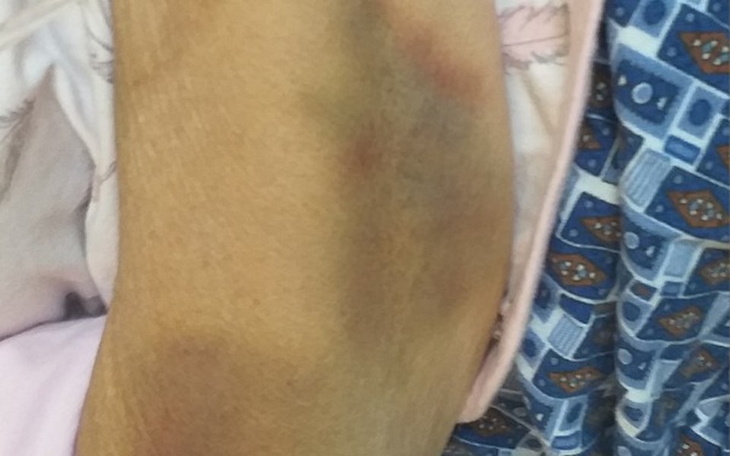 Zbiórka Udar - zdjęcie główne