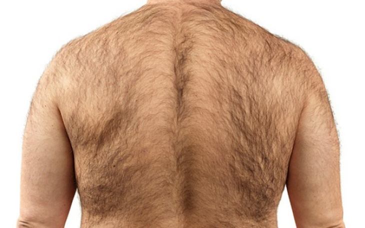 Zbiórka Zdejmijcie ze mnie to futro! - zdjęcie główne