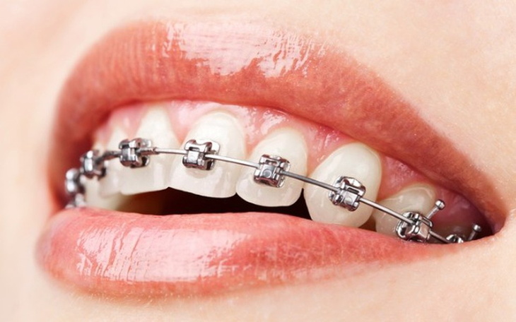 Zbiórka Na aparat ortodontyczny i łóżko - zdjęcie główne