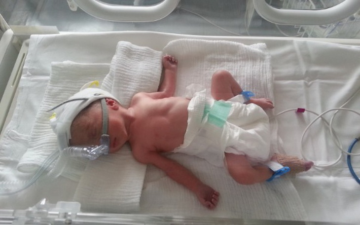 Zbiórka Leczenie córki wcześniaka - zdjęcie główne
