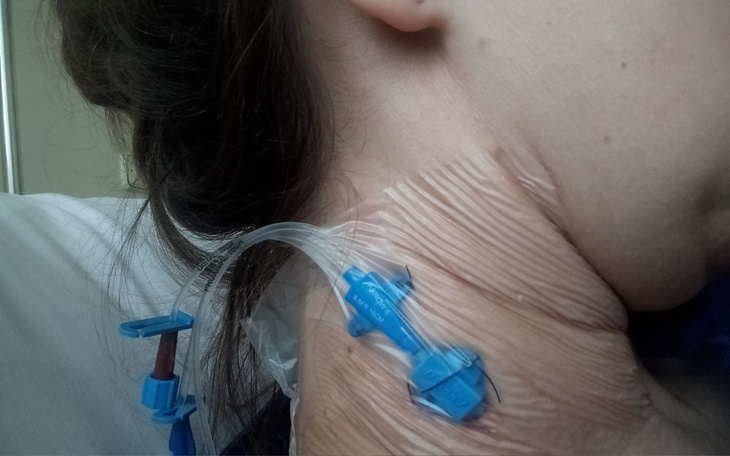 Zbiórka Lek Valhit na wirusa EBV PO 2 TX - zdjęcie główne