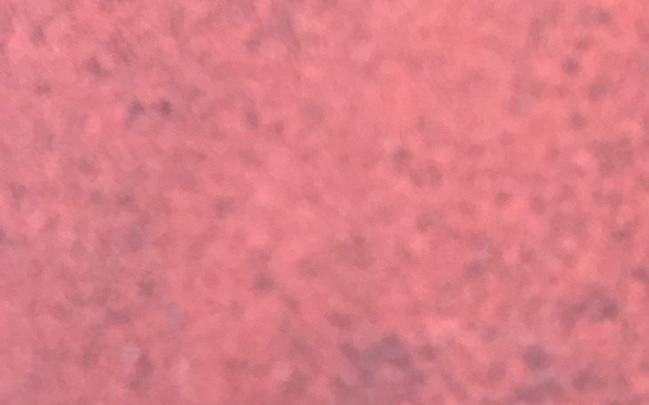 Zbiórka Na operacje stulejki - zdjęcie główne