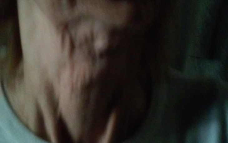 Zbiórka Leczenie i preszczep zuchwy i pr - zdjęcie główne