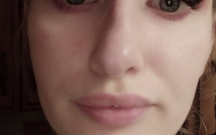 Zbiórka Operacja nosa magjk - zdjęcie główne