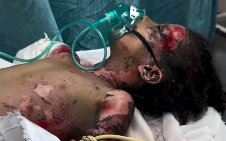 Dziecko w szpitalu z maską tlenową.