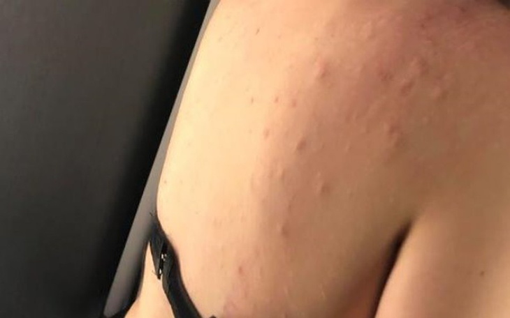 Zbiórka Połowa ciała w bliznach - zdjęcie główne