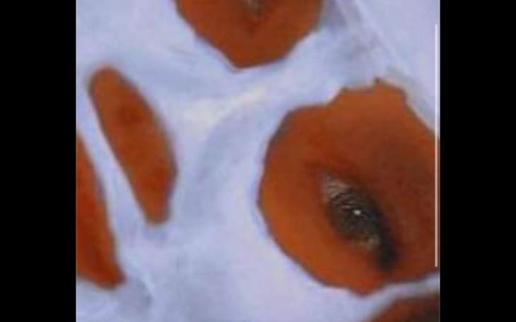 Zbiórka Operacja zeza jednooczna. - zdjęcie główne