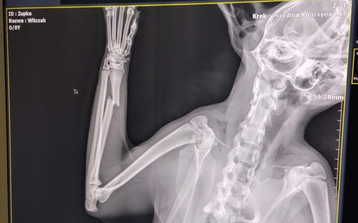Rentgen ręki, pokazujący kości i staw.