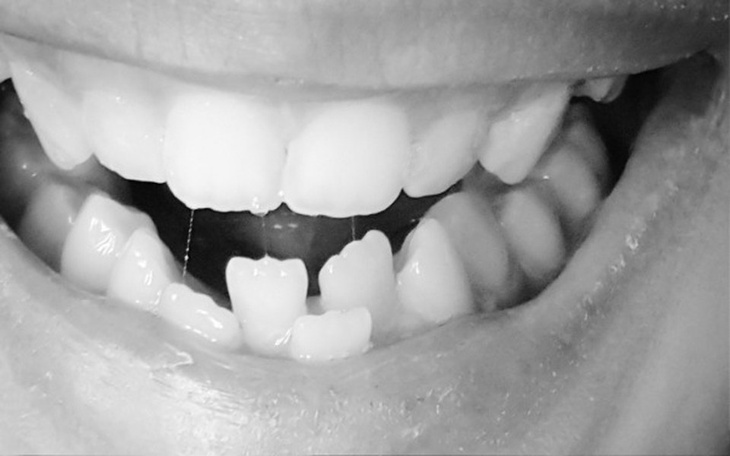 Zbiórka Proste zęby mojego syna - zdjęcie główne