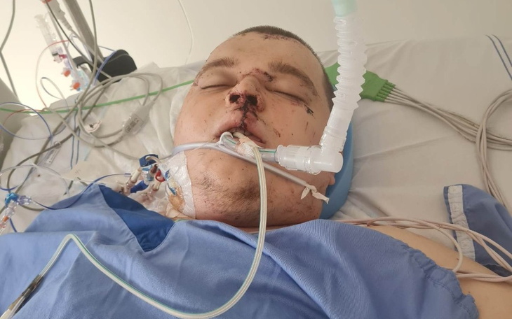 Zbiórka Leczenie,proteza i rehabilitacja - zdjęcie główne