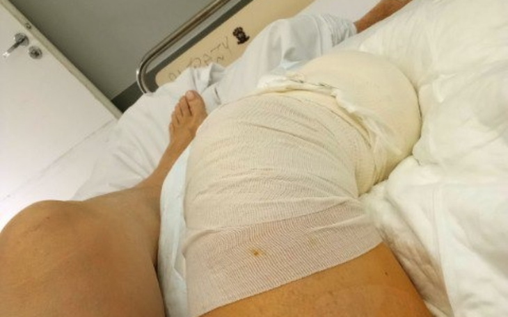 Osoba po operacji z bandażem na nodze, leżąca na łóżku szpitalnym.