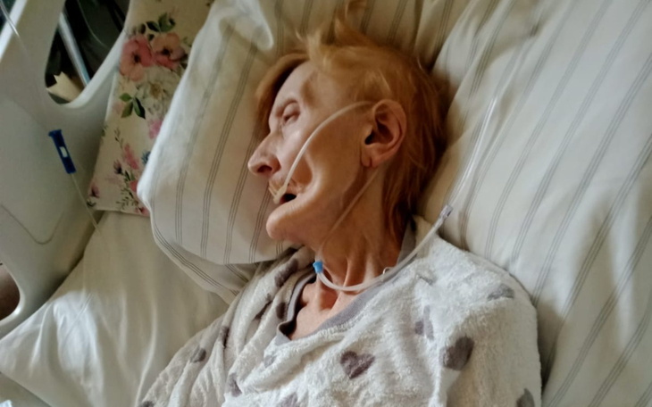 Starsza kobieta leżąca w łóżku szpitalnym, w trudnej sytuacji zdrowotnej.