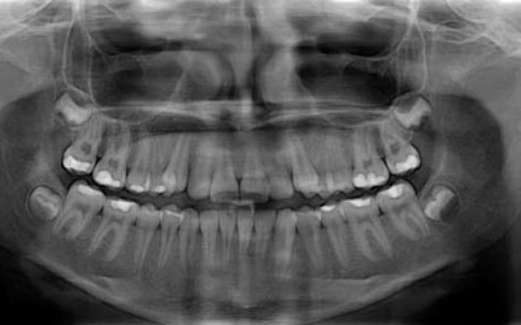 Zbiórka Wyjść na prostą2 - zdjęcie główne