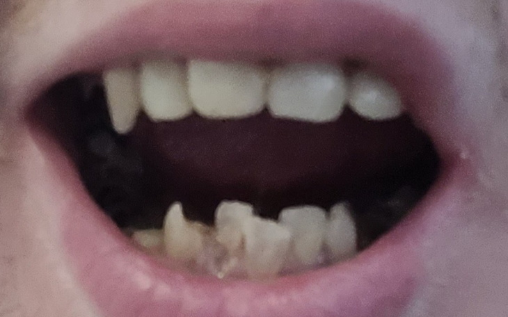 Zbiórka Zbieram na leczenie i odbudowę z - zdjęcie główne