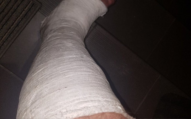 Zbiórka Rehabilitacja Nogi po napadzie - zdjęcie główne