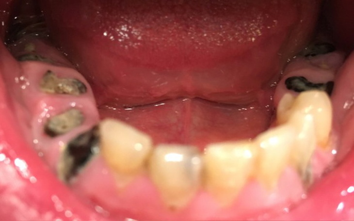 Zbiórka Na szczery uśmiech i normalność - zdjęcie główne