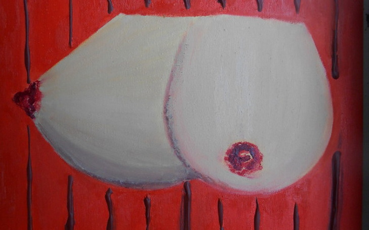 Zbiórka Na cycki - zdjęcie główne