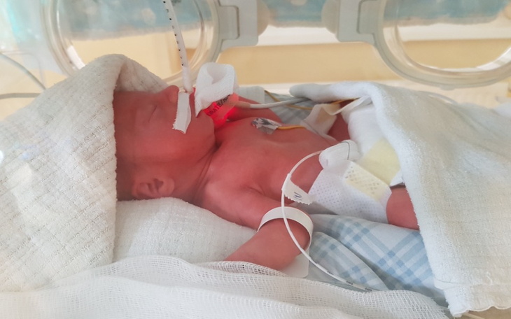 Noworodek w inkubatorze, z monitorami i opatrunkami.