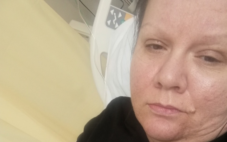 Zbiórka Nowotwór mózgu - zdjęcie główne