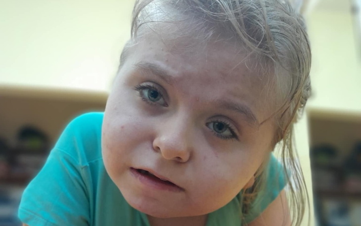 Dziecko z wyrazem twarzy pełnym ciekawości i zdziwienia.