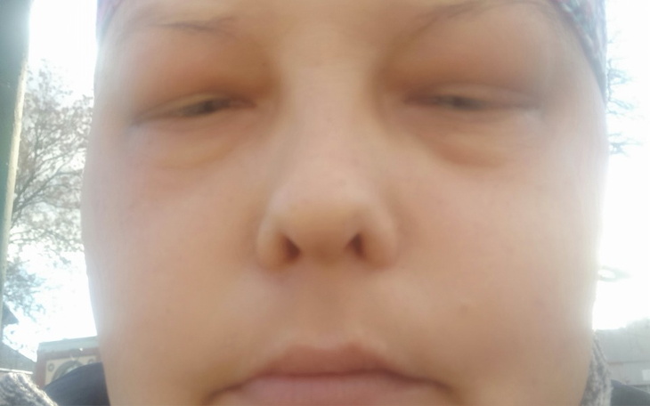 Zbiórka Na dalszą walkę z Rakiem - zdjęcie główne