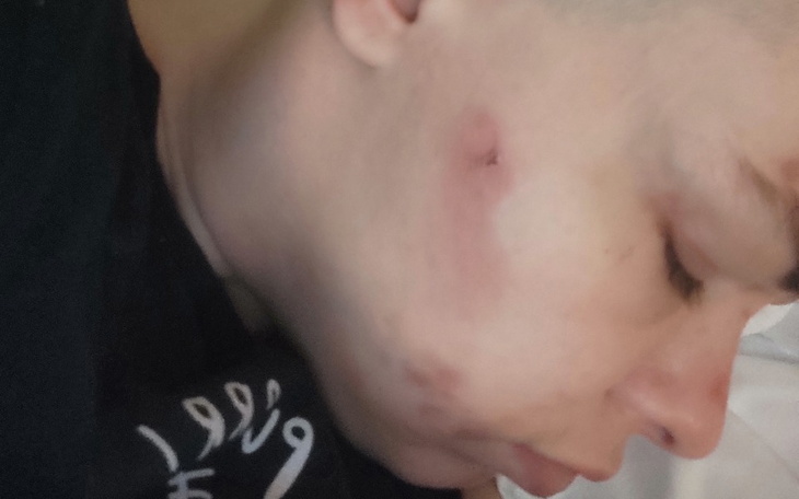 Zbiórka Od nowa chce żyć - zdjęcie główne