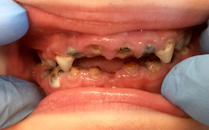 Zbiórka Na zęby dla kolegi Błażeja - zdjęcie główne