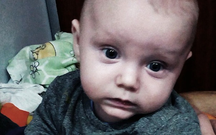 Zbiórka Leczenie stópki Kajetana - zdjęcie główne