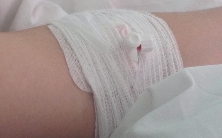 Ręka z opatrunkiem, symbolizująca potrzebę wsparcia medycznego.