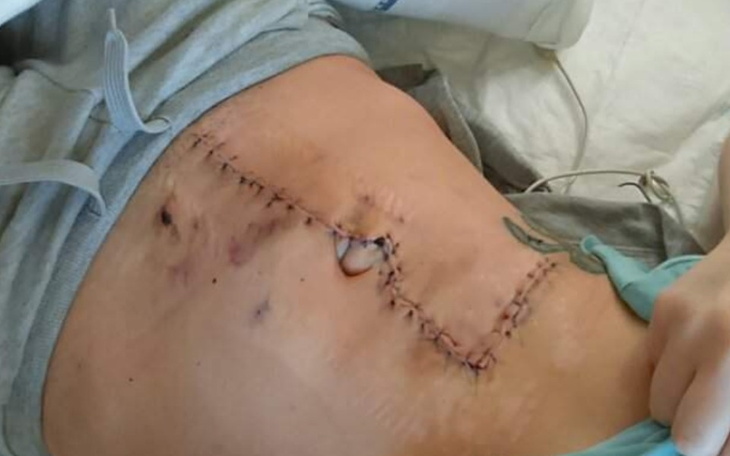 Zbiórka Traumo żegnaj na zawsze - zdjęcie główne