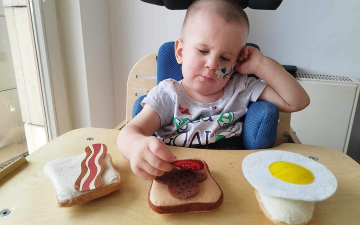 Małe dziecko bawiące się zabawkami w kształcie jedzenia.