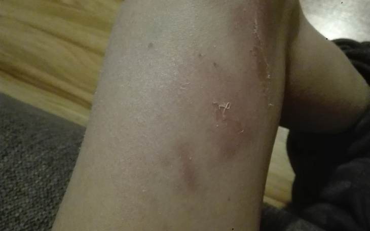 Zbiórka Funduszu dla ofiar przemocy domo - zdjęcie główne