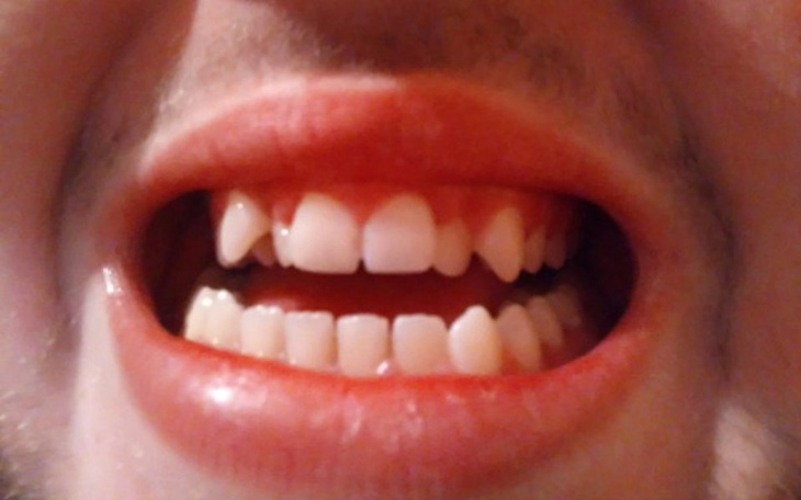 Zbiórka Aparat ortodontyczny - zdjęcie główne