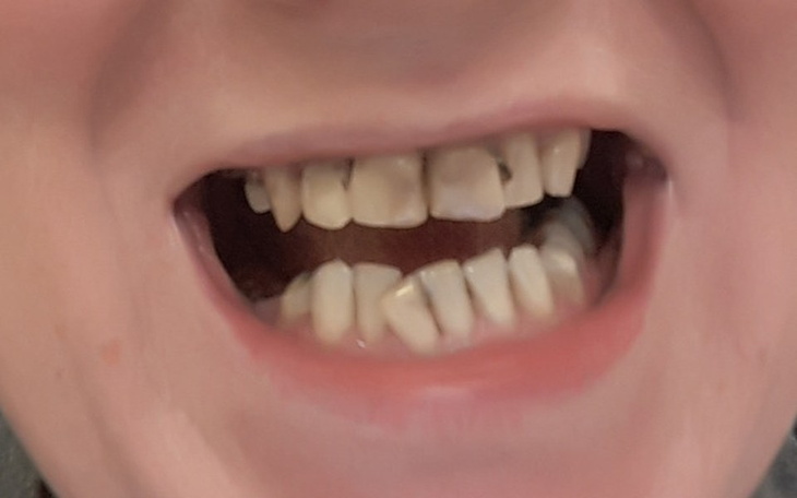 Zbiórka Leczenie zębów po chorobie - zdjęcie główne