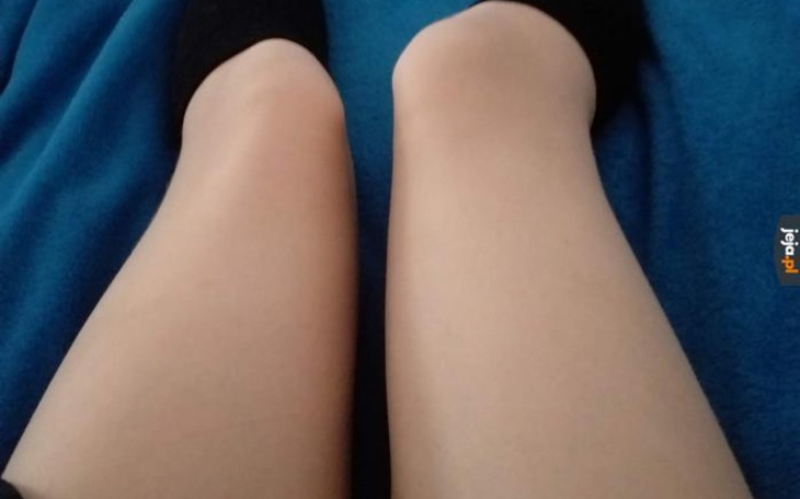 Zbiórka Nogi dla RommStera - zdjęcie główne